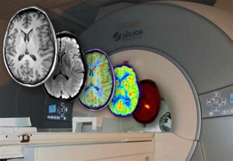 the villages mri brain scan|Neurosciences .